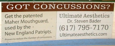 concussion